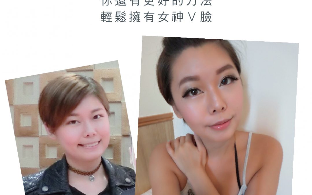 肉毒小臉見證