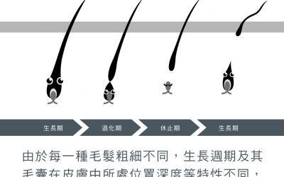 腋下粉餅雷射除毛